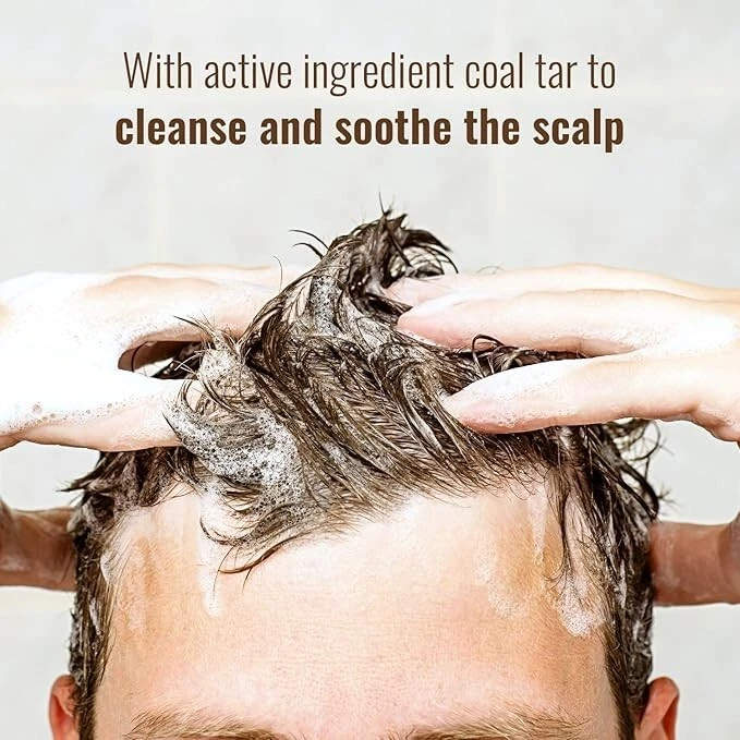 Polytar Scalp Shampoo, Coal Tar Solution 4%, For Scalp Treatments - 150ml4